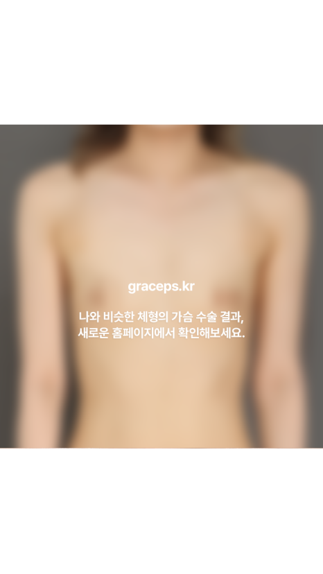 How Can Breast Augmentation Surgery Pain and Side Effects Be Reduced? image 7
