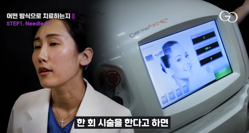 그레이스오앤영성형외과 유튜브 Best 영상 관련 이미지 3