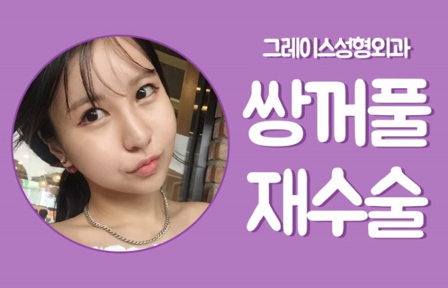 쌍꺼풀재수술 잘하는 병원은 그레이스성형외과 관련 이미지 2