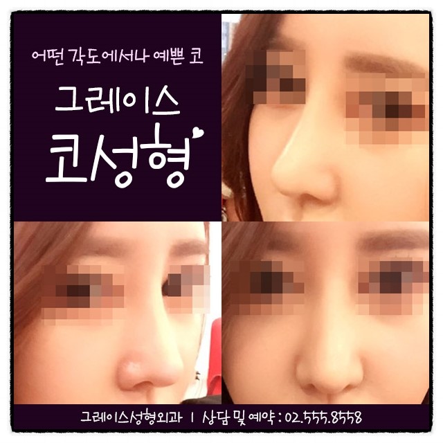 아직도 망설이신다면? 그레이스성형외과 피팅코 관련 이미지 3