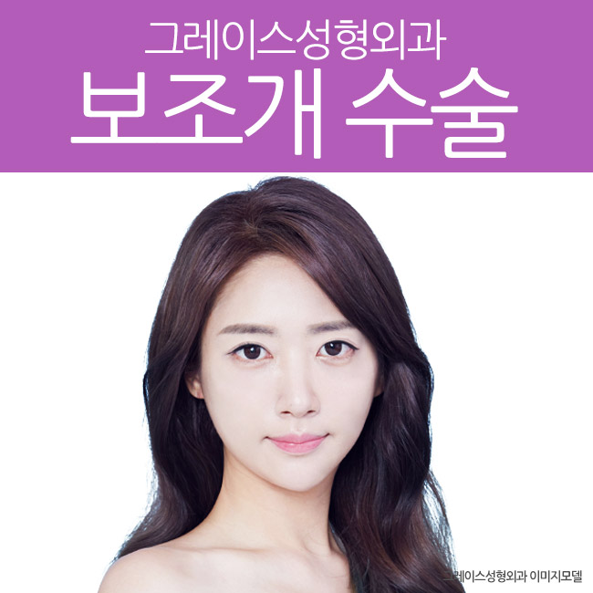 핫한 보조개수술, 신사역 그레이스성형외과에서 관련 이미지 2