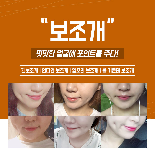 예쁜 웃음으로 연말을 따뜻하게! 그레이스성형외과 보조개수술 관련 이미지 2