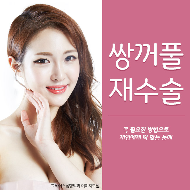 신사역 그레이스성형외과 최문섭원장님의 쌍꺼풀재수술 관련 이미지 5