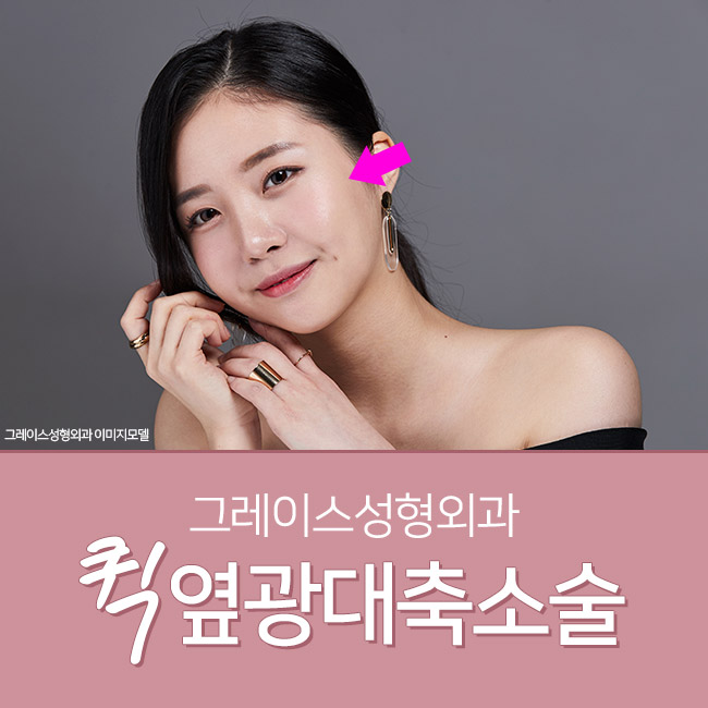 See the Quick Zygoma Effect for Yourself! image 2