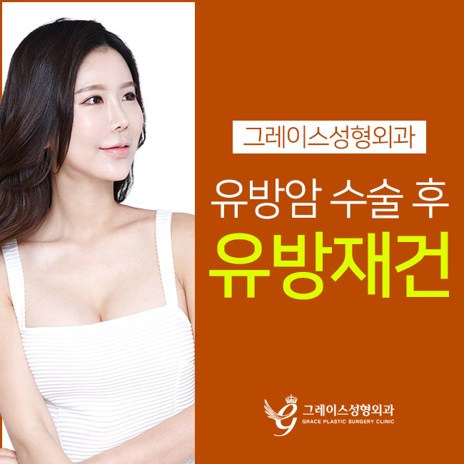 유방복원수술비용을 알아본다면 관련 이미지 2