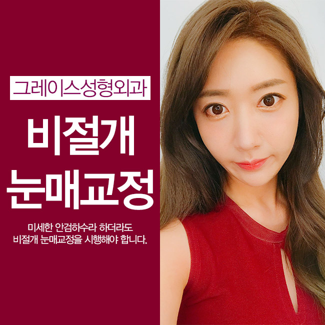 비절개눈매교정 안검하수를 교정해 또렷한 눈매를! 관련 이미지 4
