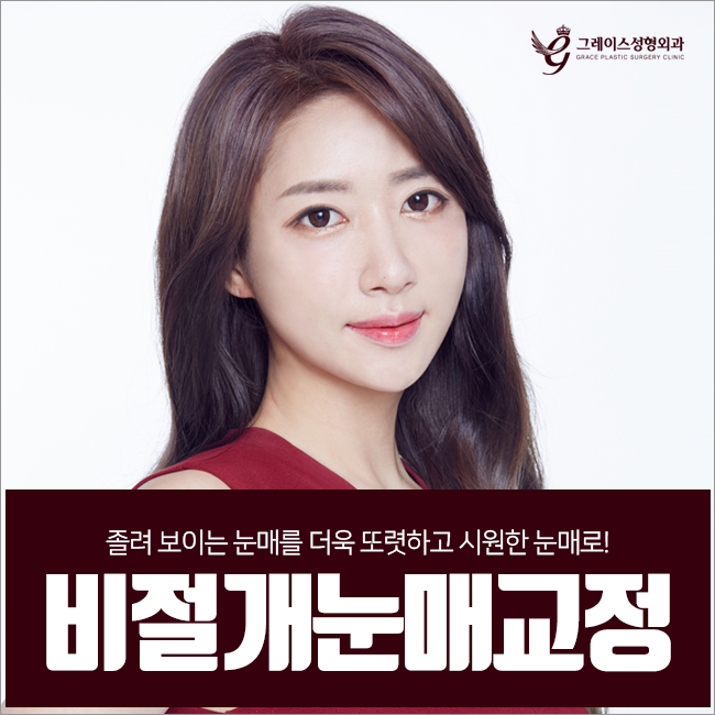 비절개눈매교정가격 바로 여기서 부담없이 관련 이미지 1