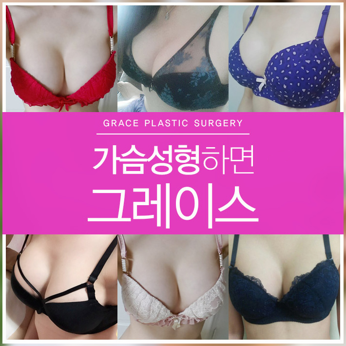 가슴재수술유명한곳 따져야할것은? 관련 이미지 2