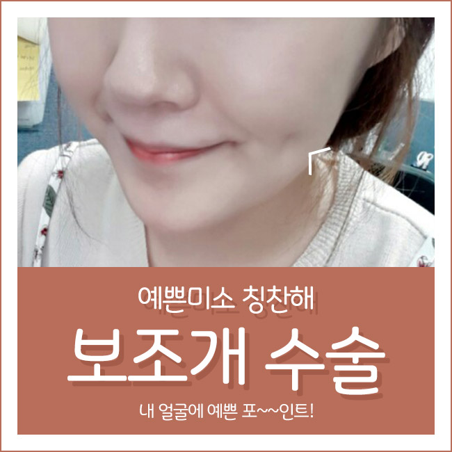 보조개수술 잘하는 곳! 그레이스성형외과 관련 이미지 3