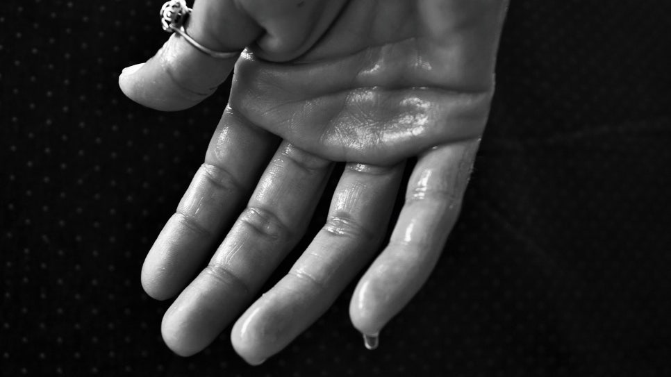 About Hyperhidrosis image 1