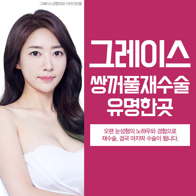 쌍꺼풀재수술유명한곳은 바로 여기지! 관련 이미지 4