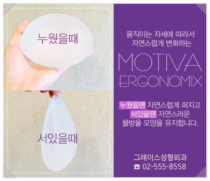 모티바후기, 그레이스성형외과가 좋은 이유 관련 이미지 3
