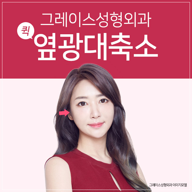 옆광대축소, 툭 튀어나온 옆광대를 부드럽게 관련 이미지 1