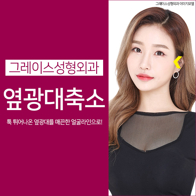 옆광대축소, 툭 튀어나온 옆광대를 부드럽게 관련 이미지 2