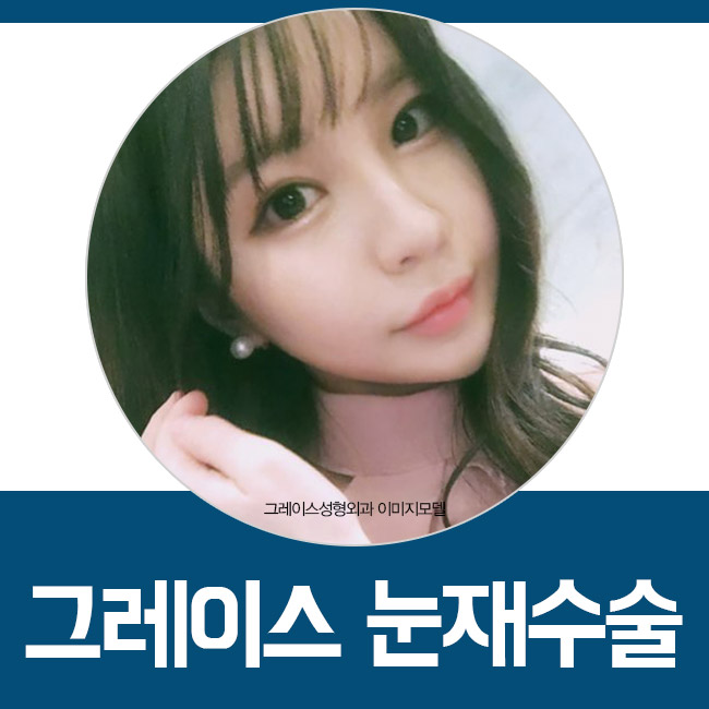 재발한 안검하수 그레이스성형외과에서 해결! 관련 이미지 2