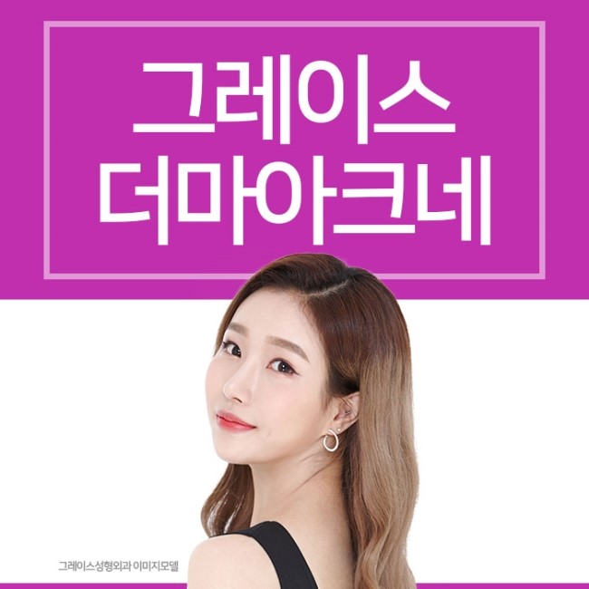 신개념 여드름치료 시술 더마아크네를 알아보자 관련 이미지 3