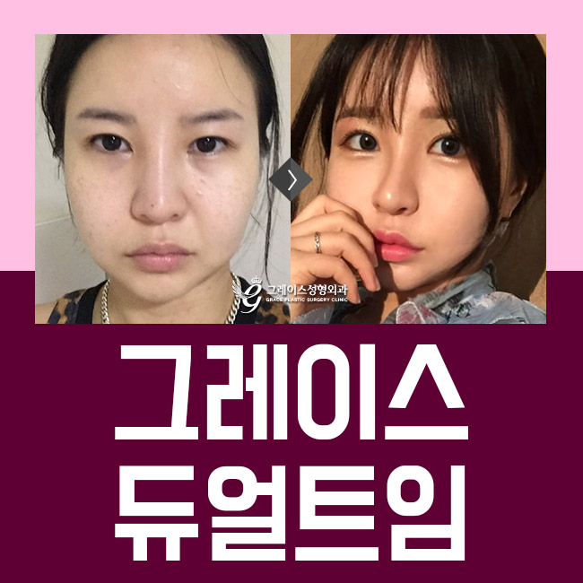 순하고 부드러운 인상을 주는 듀얼트임가격을 알아본다면 관련 이미지 2