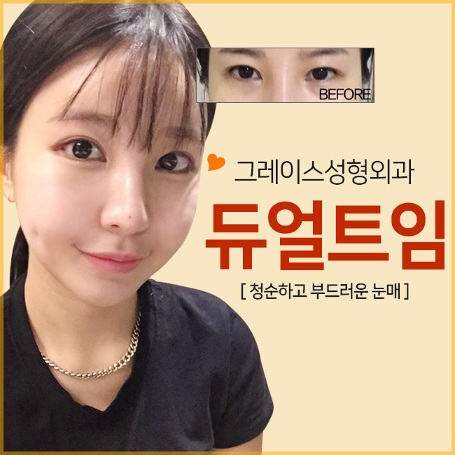 청순 눈매, 합리적인 듀얼트임가격 관련 이미지 3