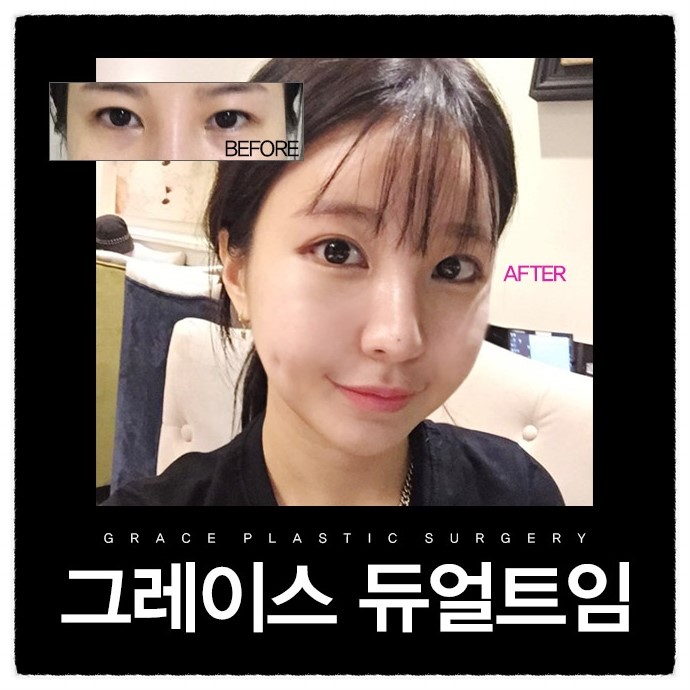시원하고 청순한 리얼 듀얼트임후기 관련 이미지 4