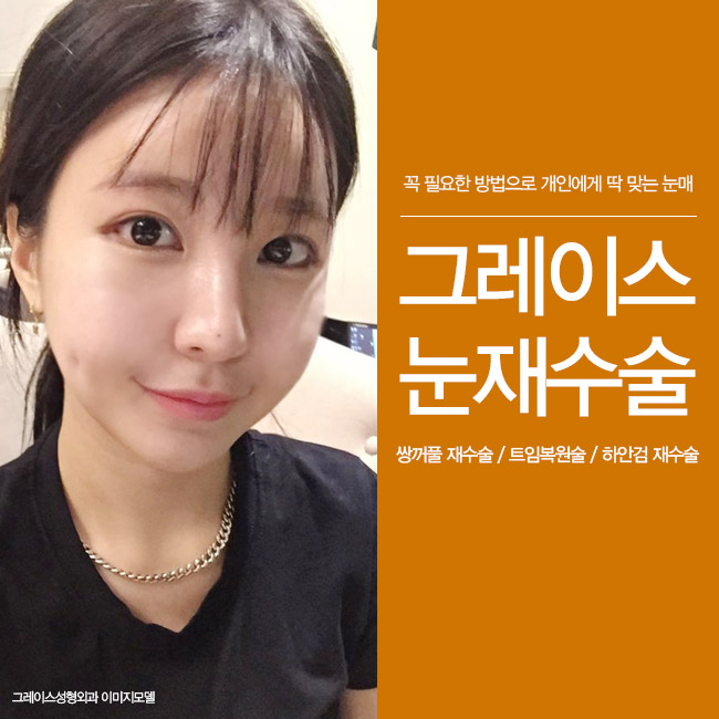 최문섭원장님이 들려주는 그레이스성형외과 눈재수술 관련 이미지 4