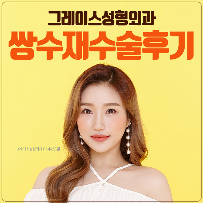 쌍수재수술후기 마지막 수술이 됩니다. 관련 이미지 1