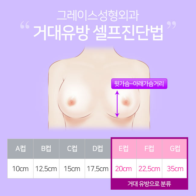 Breast Reduction Surgery Cost, All the Way to Satisfactory Results image 3