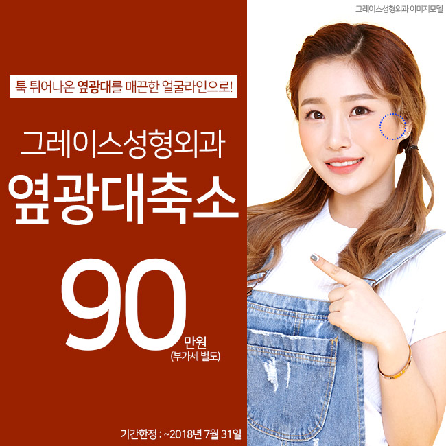 옆광대축소, 툭 튀어나온 옆광대를 부드럽게 관련 이미지 5