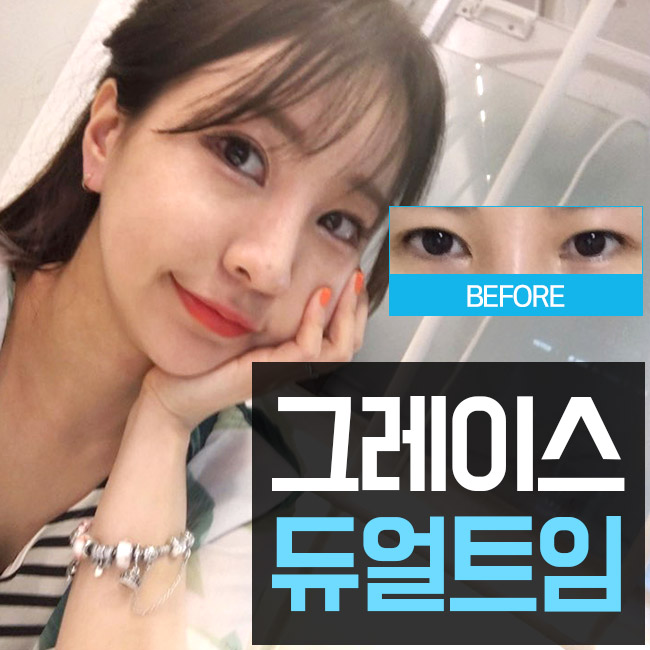 부드러운 인상 듀얼트임후기와 가격을 알아본다면 관련 이미지 2