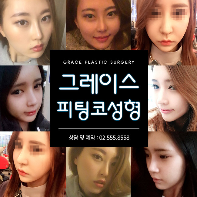 그레이스성형외과 피팅코, 자유자재로 움직이는 코성형의 완성! 관련 이미지 4