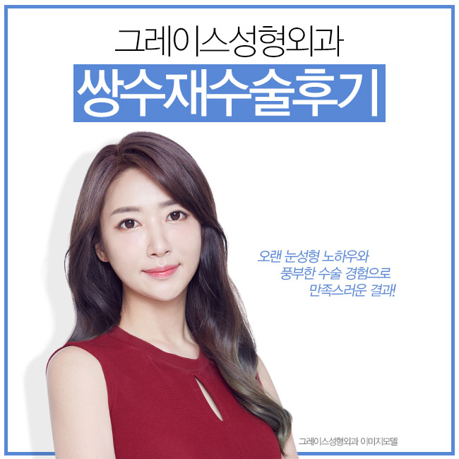 쌍수재수술후기 이곳이 정답인 이유 관련 이미지 4
