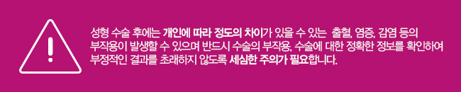 가슴재수술도 역시 모티바가 정답 관련 이미지 8