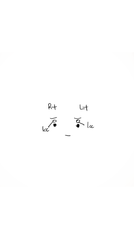 그레이스성형외과 눈두덩이 꺼짐 지방이식 전후 비교 관련 이미지 2