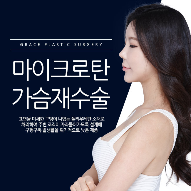 바로 이거다! 그레이스성형외과 마이크로탄 가슴재수술 관련 이미지 1