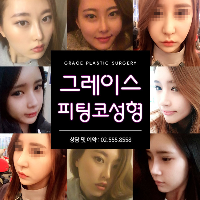 자연스러운 코성형은 그레이스성형외과 피팅코 성형 관련 이미지 2