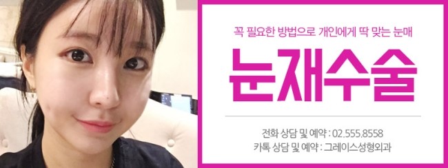 그레이스성형외과 눈재수술에 대해 알아보자! 관련 이미지 2