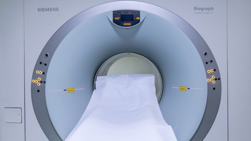 Stroke Diagnosis Methods image 1