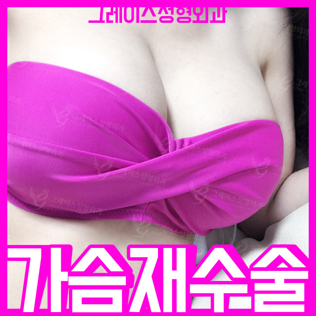 가슴재수술잘하는곳 한 번에 만족하려면 관련 이미지 1