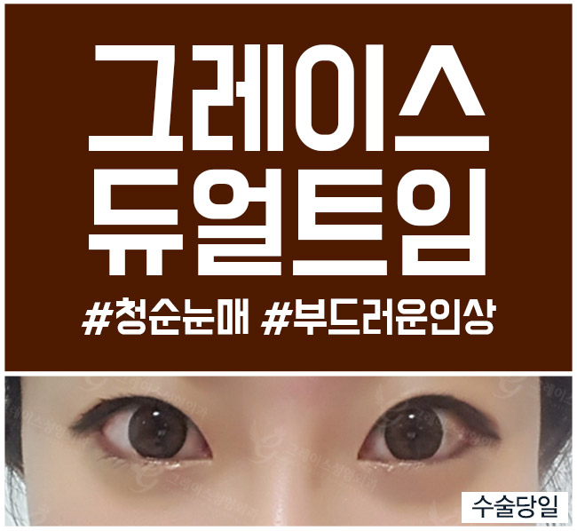 합리적인 듀얼트임가격과 만족스러운 결과 관련 이미지 5