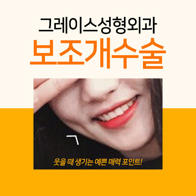 보조개수술후기 만족스러워! 관련 이미지 5
