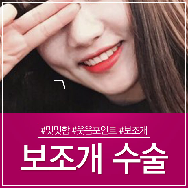 보조개수술후기, 매력적인 이미지 변신 관련 이미지 3