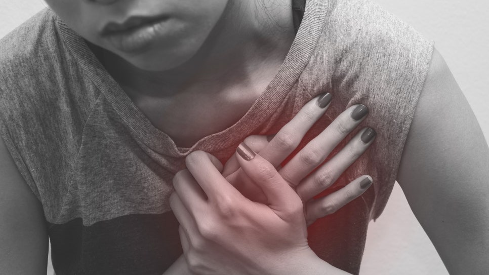 Acute Myocardial Infarction and Its Causes image 1