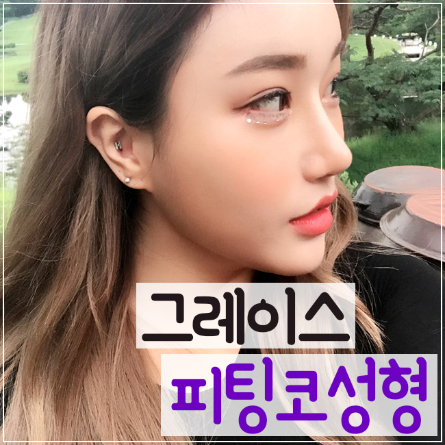 예쁜 라인과 자연스러운 움직임, 그레이스성형외과 피팅코성형 관련 이미지 1