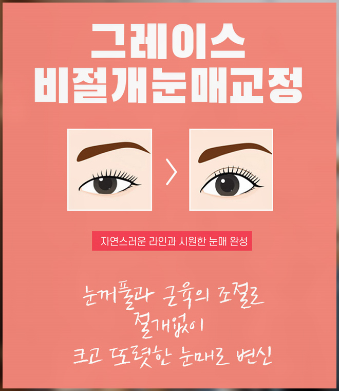 눈꺼풀처짐 안검하수증상으로 힘들다면? 관련 이미지 5