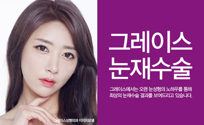 신사역 눈재수술잘하는곳, 그레이스성형외과 관련 이미지 5
