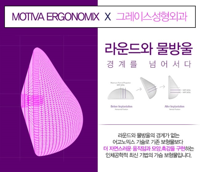 가슴성형, 그레이스성형외과 모티바보형물로 알아보자! 관련 이미지 2