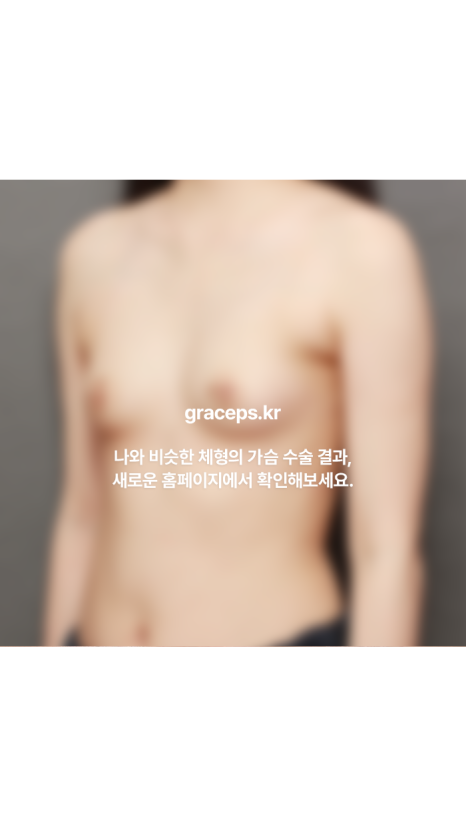 How Can Breast Augmentation Surgery Pain and Side Effects Be Reduced? image 1
