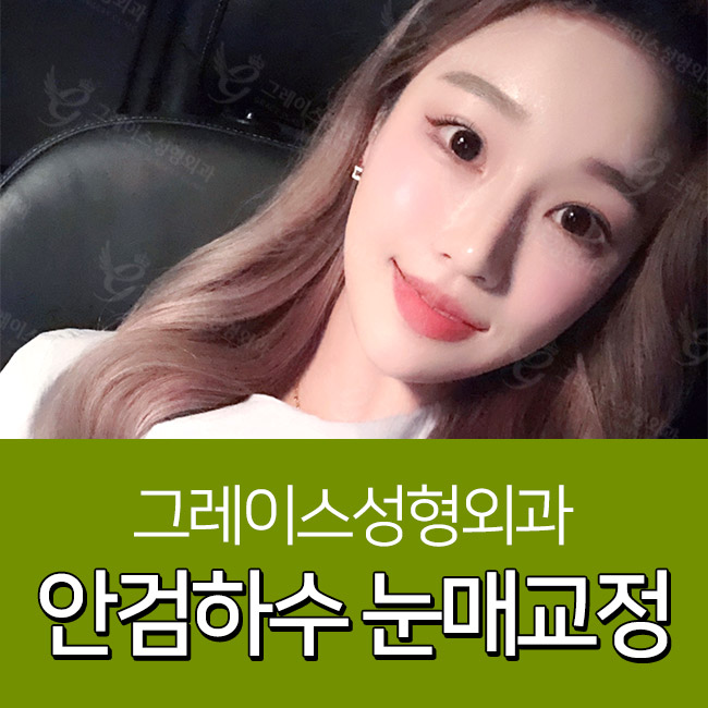 안검하수눈매교정 또렷하고 선명한 인상! 관련 이미지 1