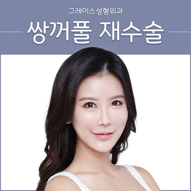 쌍꺼풀재수술하면 그레이스성형외과 최문섭 원장 관련 이미지 2