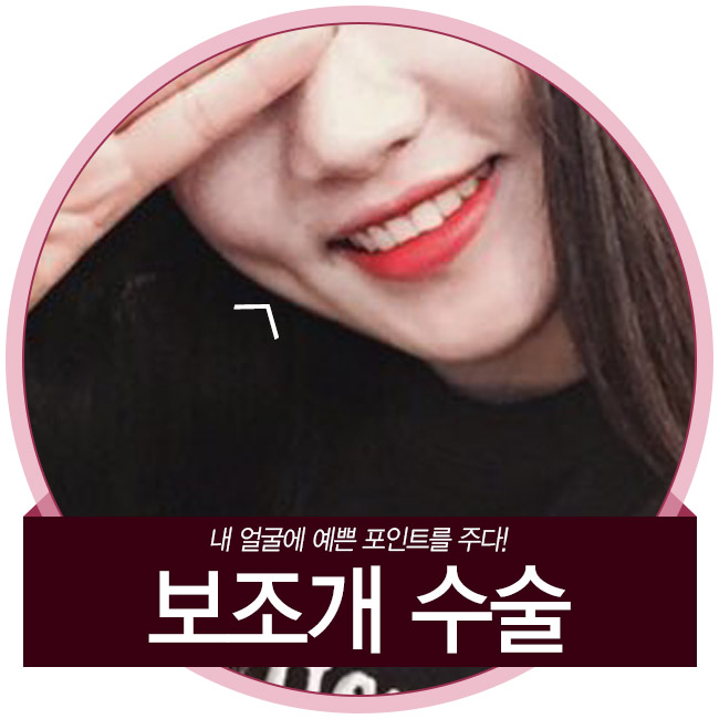 그레이스성형외과 보조개성형으로 이미지 변신 확실하게! 관련 이미지 5