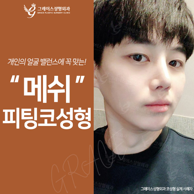 메쉬코 오똑하고 말랑한 코끝, 자연스러운 콧대라인 관련 이미지 3